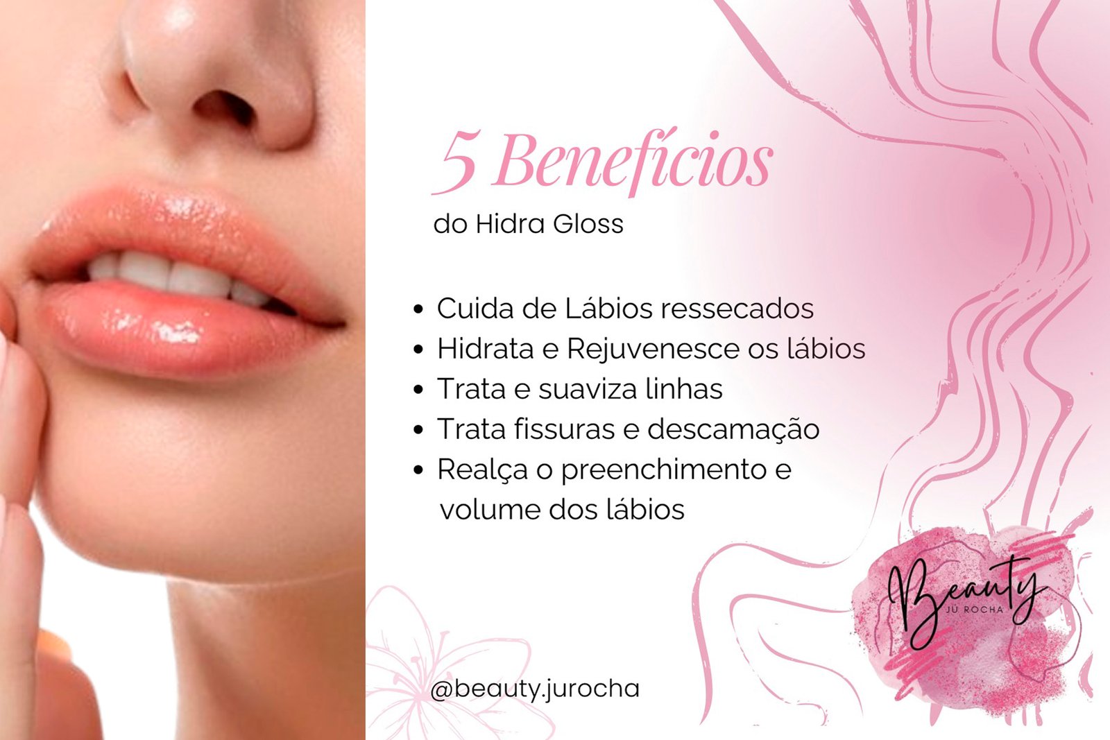 01 SESSÕES DE HIDRA GLOSS LIPS